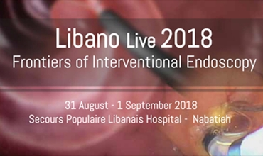 LIBANO LIVE 2018
